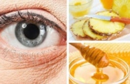إزالة تجاعيد العين eye wrinkles treatment
