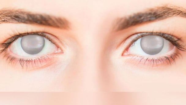 اسباب العمى المفاجئ sudden blindness in both eyes