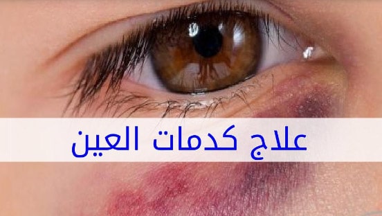 اسباب كدمات العين eye health services