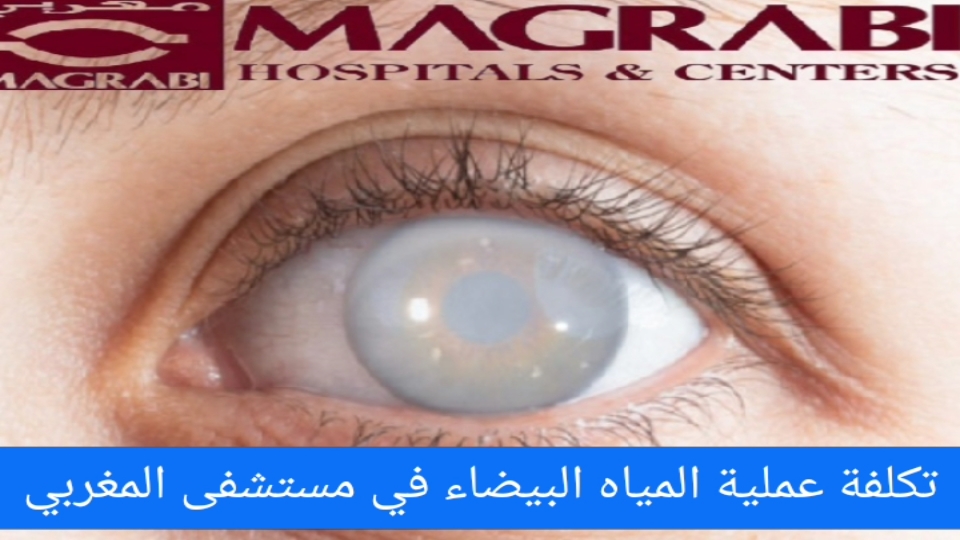 تكلفة عملية المياه البيضاء في مستشفى المغربي
