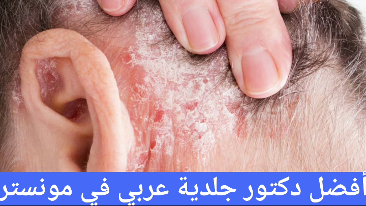 أفضل دكتور جلدية عربي في مونستر