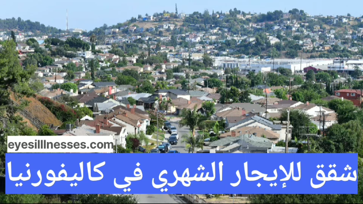 شقق للإيجار الشهري في كاليفورنيا